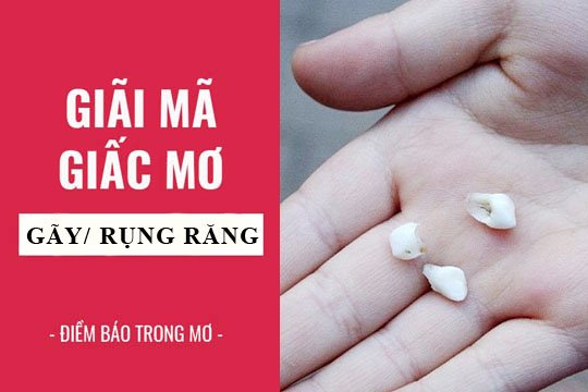 Mơ thấy rụng răng đánh con gì phát tài?