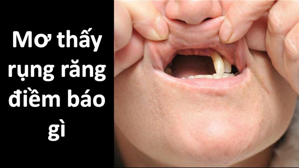 Mộng thấy người khác nhổ 1 chiếc răng của mình